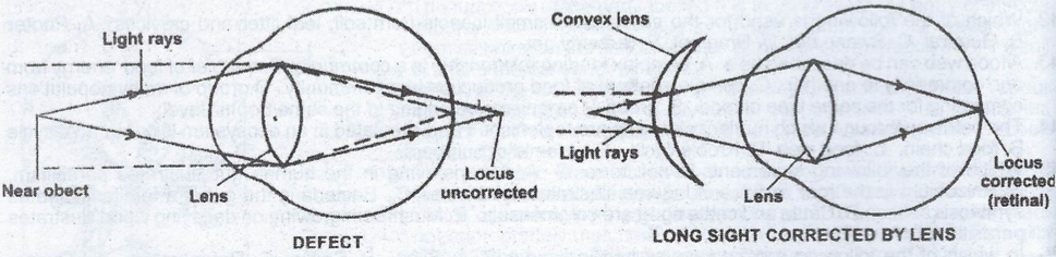 Long sightedness diagram